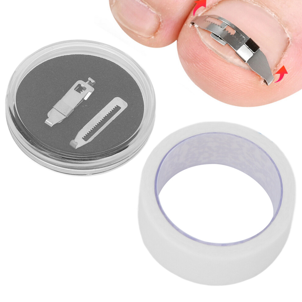Ingrown Toenail Corrector Stainless Steel Paronychia Correction Tool with Adhesive Tape for Toenail Correction