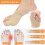Kit correcteur d'hallux valgus 20x15x4 135g 4