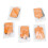 10 pièces d'électrodes Snap, silicone réutilisable, orange 10