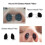 Filtre nasal invisible S/M/L Étroit/Rond 9-19mm 5