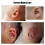 Patch d'oreille en silicone Modèle : 4x100 cm 1,6x39,4 po Transparent 4