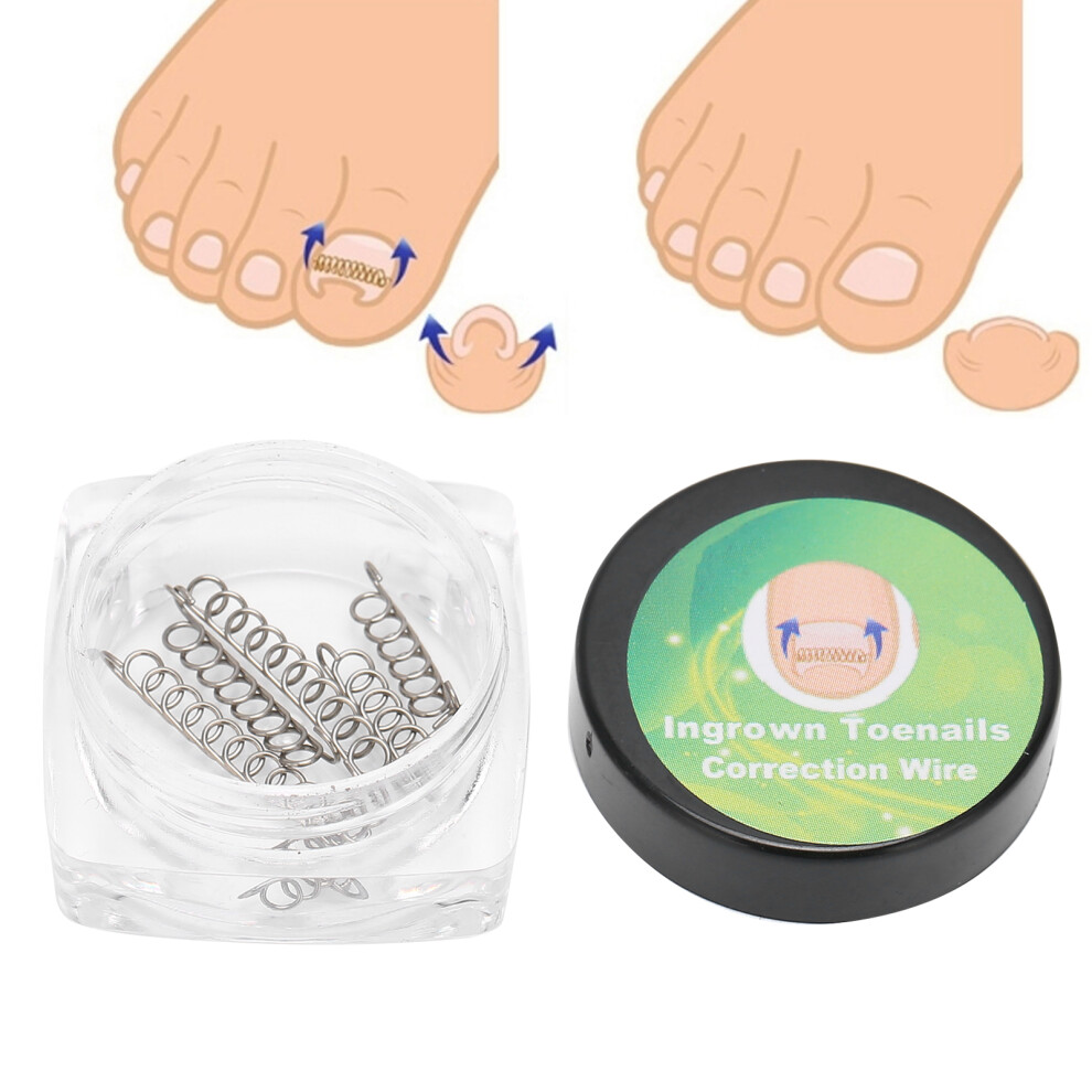 6pcs Ingrown Toenail Wire Fixer Stainless Steel Foot Care Pedicure Tools for Toenail Correction