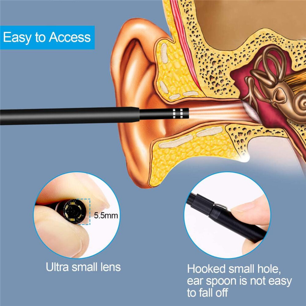 3 in 1 Ear Spoon Intelligent Visual Ear Picking Multifunctional Soft Ear Wax Removal Tool for Nasal Cavity Teeth