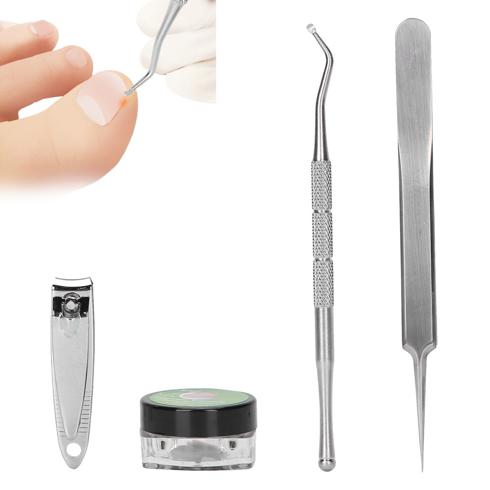 Ingrown Toe Nail Correction Pad Nail Clipper Ingrown Toenail Lifter Tweezers Pedicure Tools(50pcs PadSevere Ingrown Nail )