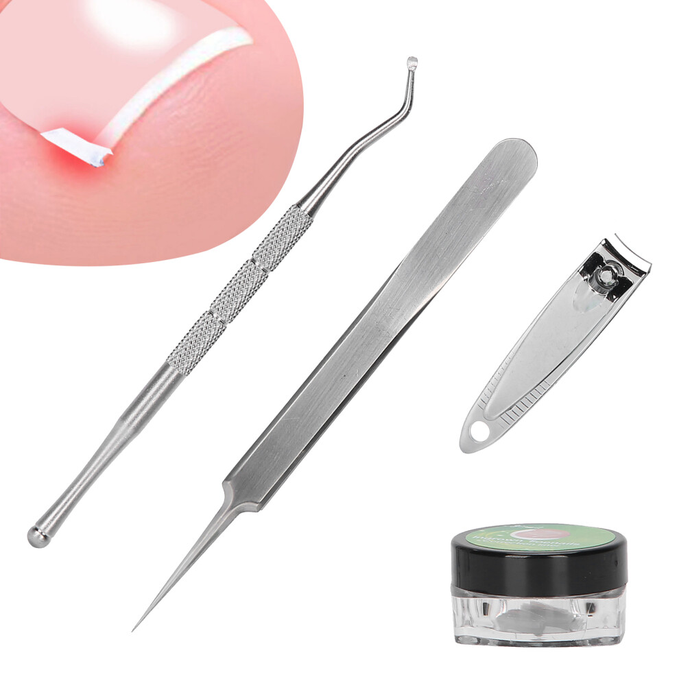 Ingrown Toe Nail Correction Pad Nail Clipper Ingrown Toenail Lifter Tweezers Pedicure Tools(12pcs PadMild Ingrown Nail )