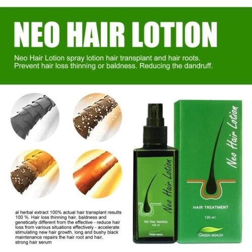 Neo Hair Lotion (1 Stück) – Anti-Haarausfall-Lotion, Essenz-Serum, Öl, Haarwuchsbehandlung 2
