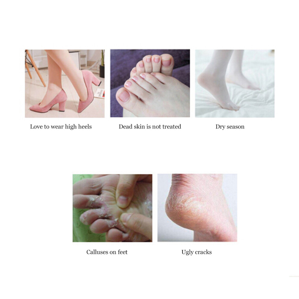 Electric Foot File Grinder Dead Skin Callus Remover Pedicure Heel Machine Foot CareGold
