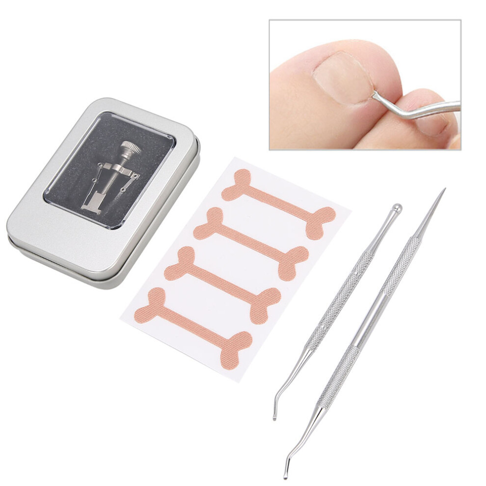 Ingrown Toenail Correction Patch Ingrown Nail Corrector Cuticle Pusher Nail File KitSilver