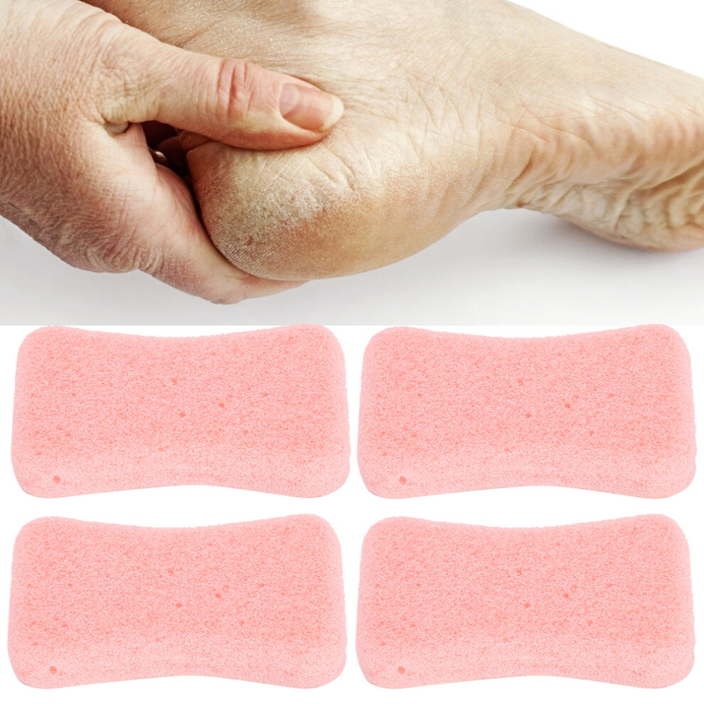 4pcs Callus Exfoliate Stone Feet Care Pumice Stone Feet Hard Skin Remove Pedicure ScrubberPink