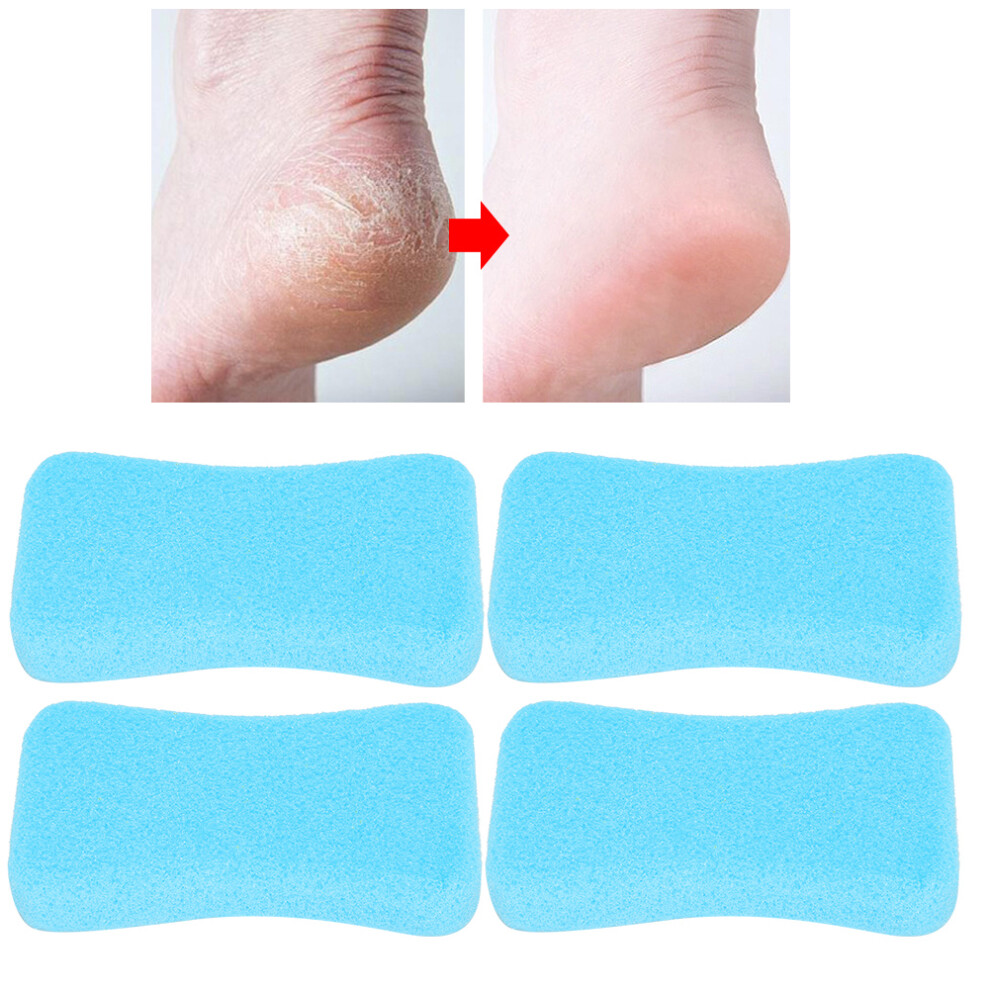 4pcs Callus Exfoliate Stone Feet Care Pumice Stone Feet Hard Skin Remove Pedicure ScrubberBlue