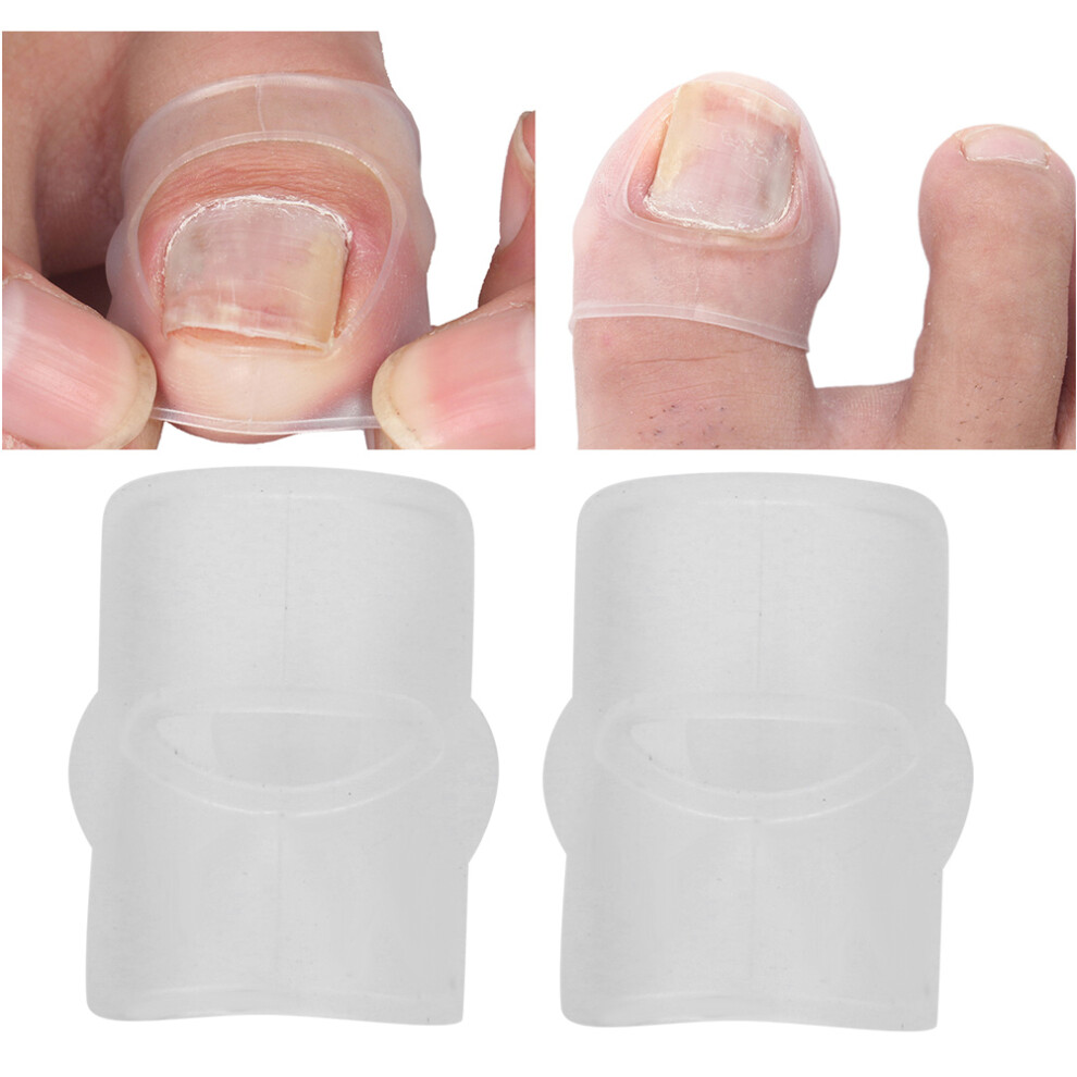 2pcs Silicone Ingrown Toenail Correcting Tool Pain Relief Paronychia Treatment Corrector