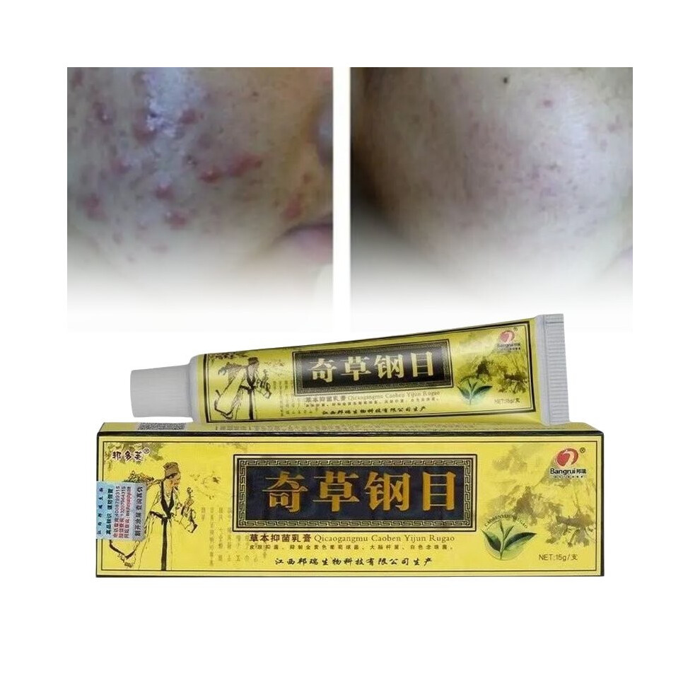 Antibacterial Herbal Treat Pimples Acne Eczema Elasticity Skin Restores Cream