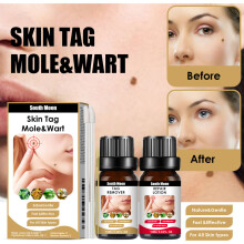 Mole Remove Fast Wart Cream Gentle Natural For All Skin Types Care Skin Cream