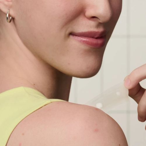 Buyfiy Hydrocolloïde Spot Patch voor lichaam, wang, voorhoofd en kin 2
