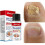 20 ml - Nagelpilzbehandlung, 7 Tage, Essenz, Serum, Pflegeöl, N64.Freight, 1