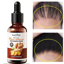 Serum voor snelle haargroei met essentiële Lauren-olie, tegen haaruitval, voorkomt uitdroging en dunner wordend haar