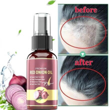 ml – Anti-alopecia haargroeispray, 100% natuurlijk, essentiële essentie van