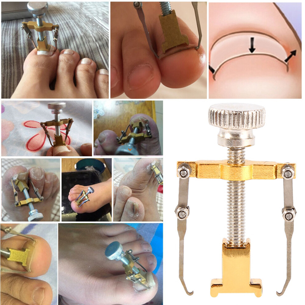 Professional Ingrown Toe Nail Recover Correction Fixer Manicure Pedicure Nails Care Tool