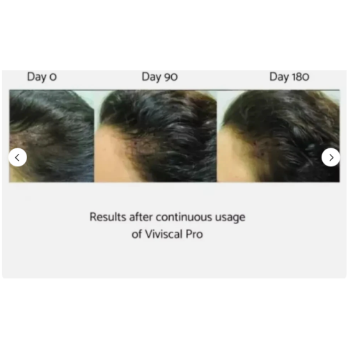 VIVISCAL PRO - Professional Hair Growth Tablets 180 2