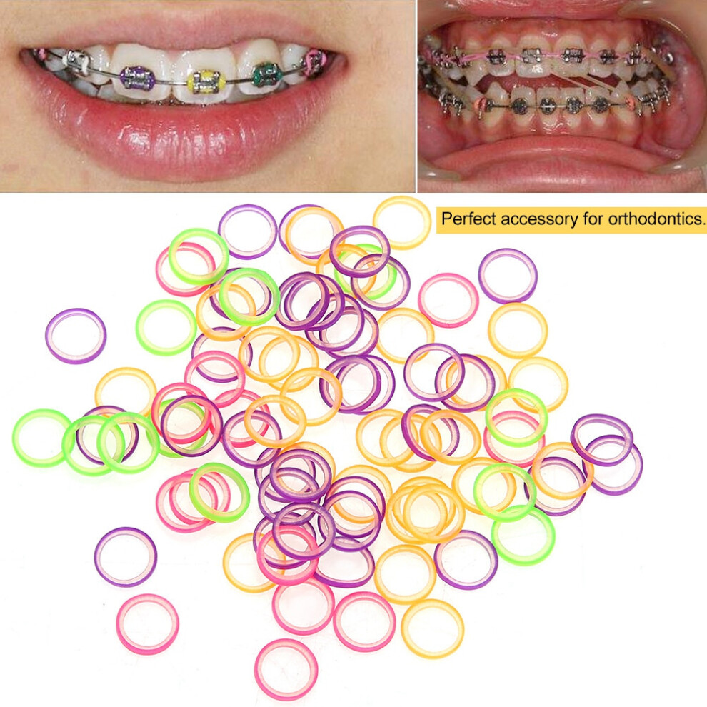100Pcs/set Professional Dental Elastic Teeth Rubber Band Oral Orthodontics Tool 3.5oz
