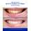 Supersmile Professional Toothpaste (4.2 oz  Cinnamon) 3