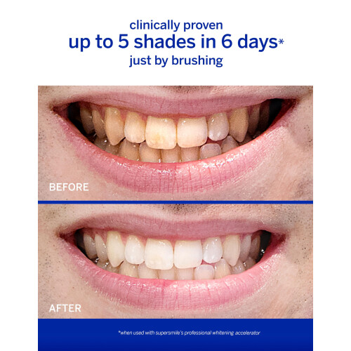 Supersmile Professional Toothpaste (4.2 oz  Cinnamon) 2