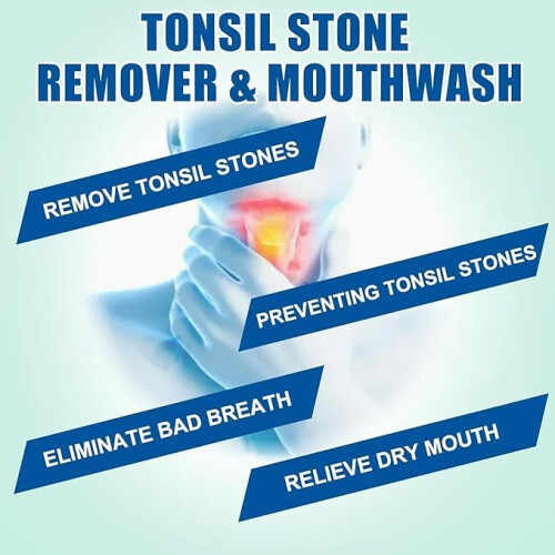Tonsil Spülung - Entferner von Tonsilstein Mundwasser 2
