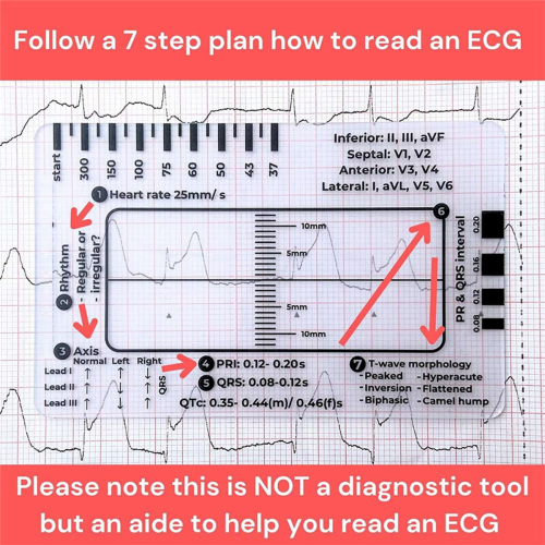 ECG 7 Step Ruler, Rapid Quick Cardiac Analysis and Measurement Tool 2
