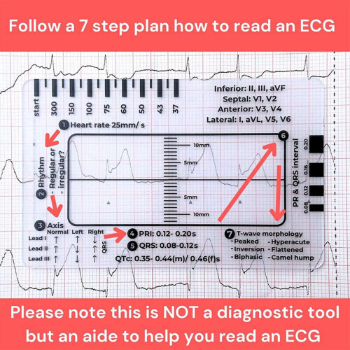 ECG 7 Step Ruler, Rapid Quick Cardiac Analysis and Measurement Tool 1
