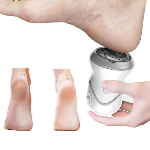 Electric Foot Grinder Pedicure Remove Foot Skin Usb Charge 2