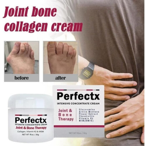 Perfectx Joint and Bone Therapy Cream, Perfectx Joint and Bone Therapy Cream (3 pcs) 1