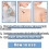 Skin tag removal fluid, skin tag treatment, wart removal 4