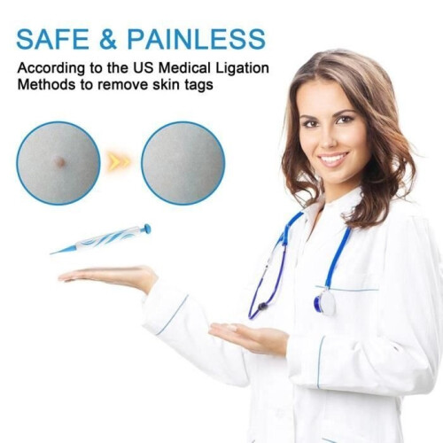 2-in-1 Automatic Micro Skin Tag Removal Kit, Automatic Skin Tag Removal Device 2