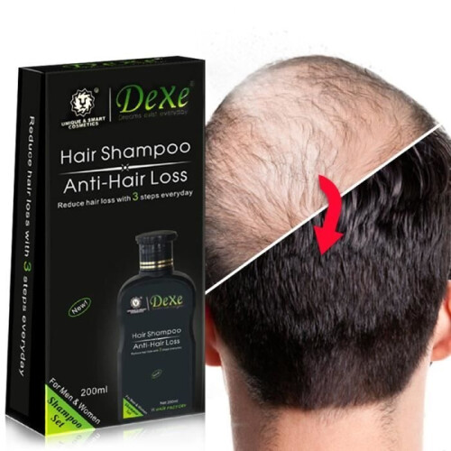 Shampoo anticaduta - Shampoo anticaduta, prodotto a base di erbe cinesi, trattamento