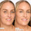 tarte shape tape radiant medium coverage concealer - 35H medium honey (medium skin with warm  peach undertones) 2