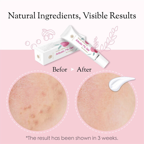 Don Du Ciel 7% Alpha Arbutin for Dark Spot Remover 2