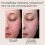 EltaMD Eltamd UV Skin Recovel 3