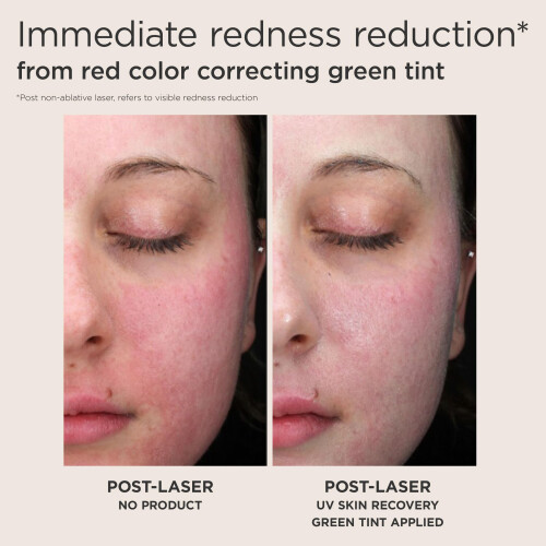 EltaMD Eltamd UV Skin Recovel 2