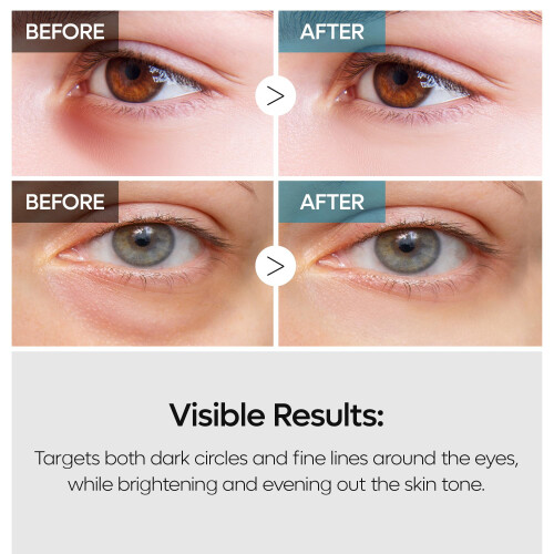 TX Retinalsome Doppeleffekt Augencreme 2