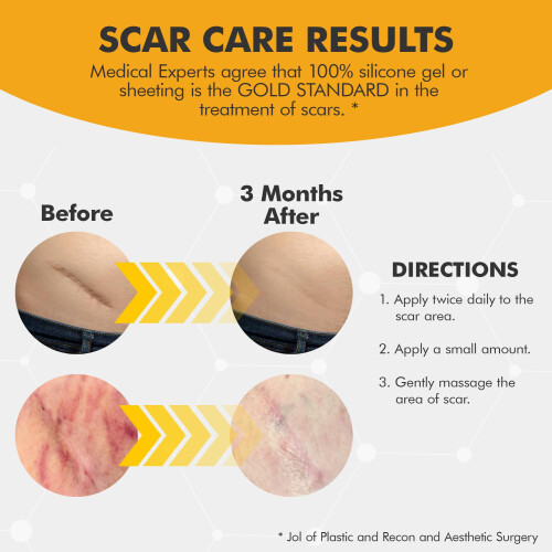 DermAvance Pure Scar Care "Ιατρική Σιλικόνη" για Χειρουργικές και Προσωπικές Ουλές - 1.05822 fl oz (3) 2