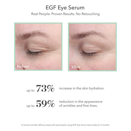 BIOEFFECT EGF Oogserum met De-Puffer Rollerball, Anti-Aging, Hydraterende Gel 1