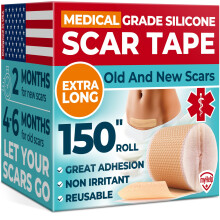 Medische siliconen litteken tape - Transparant (1.6"x150") - Zichtbare verbetering bij littekens