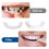 2 Ζεύγη Snap in Δόντια Comfort Fit Whitening Veneer Snap on Δεξιότητες για Όμορφο Χαμόγελο 4