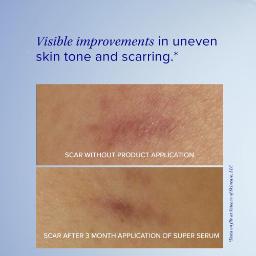 iS CLINICAL iS CLINICAL Super Serum Advance+, Ορός Προσώπου Βιταμίνης C, για Αντιγήρανση, 0.5 Fl Oz 2