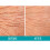 Dermactine-TS cr   pe est parti du corps corporel 3 once (2 pack) 4