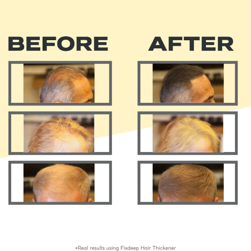 Fibri per capelli FixDeep per i capelli diradati | Impossibile e resistente al sudore - Capelli istantaneamente pi pieni in 30 secondi - 14G - Coper 1