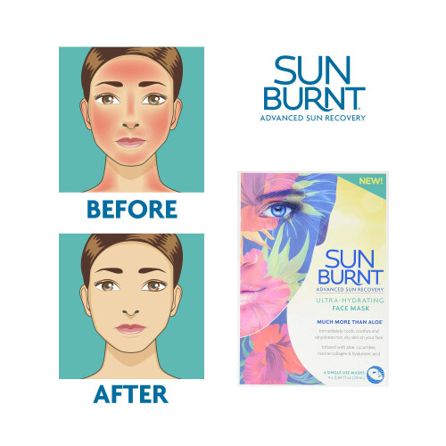 Masque de feuille de visage ultra-hydratante br   l   e de soleil 1