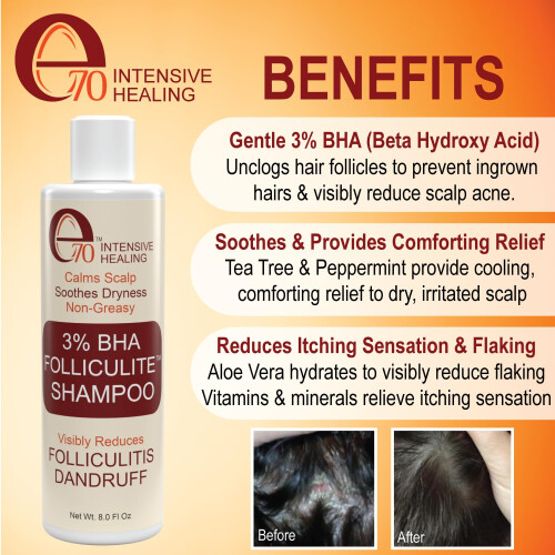 SORO DE FOLLICULITE 2% BHA E CONJUNTO DE SHAMPOO 3% BHA 1