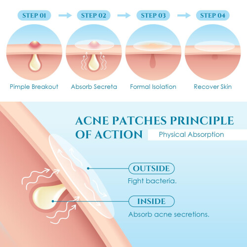 Pimple Patchs Patch acne Pather Day and Night Idrocolloid Patch per coprire 1