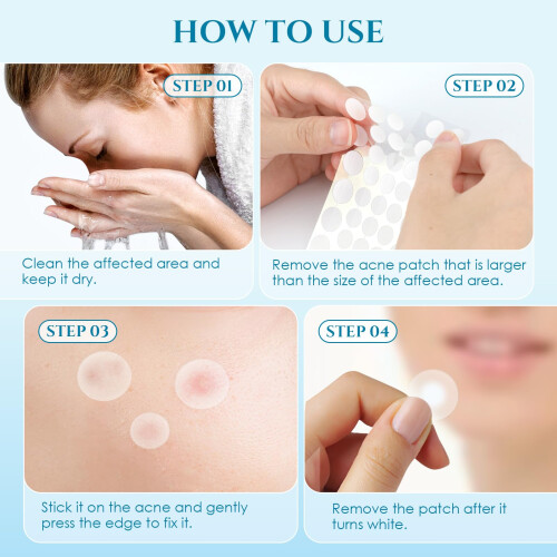 Pimple Patchs Patch acne Pather Day and Night Idrocolloid Patch per coprire 2